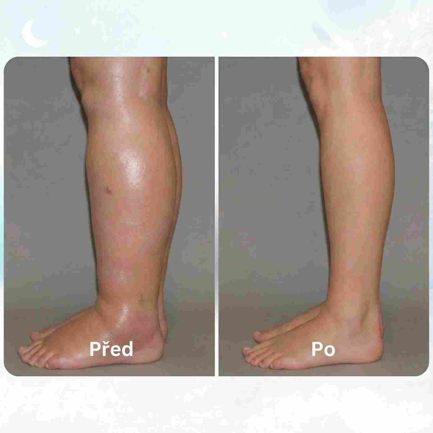 LOOMA - EMS RISOLVE LE GAMBE GONFIE DA CASA
