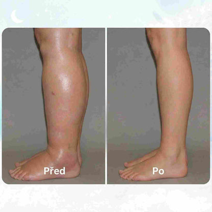 LOOMA - EMS RISOLVE LE GAMBE GONFIE DA CASA