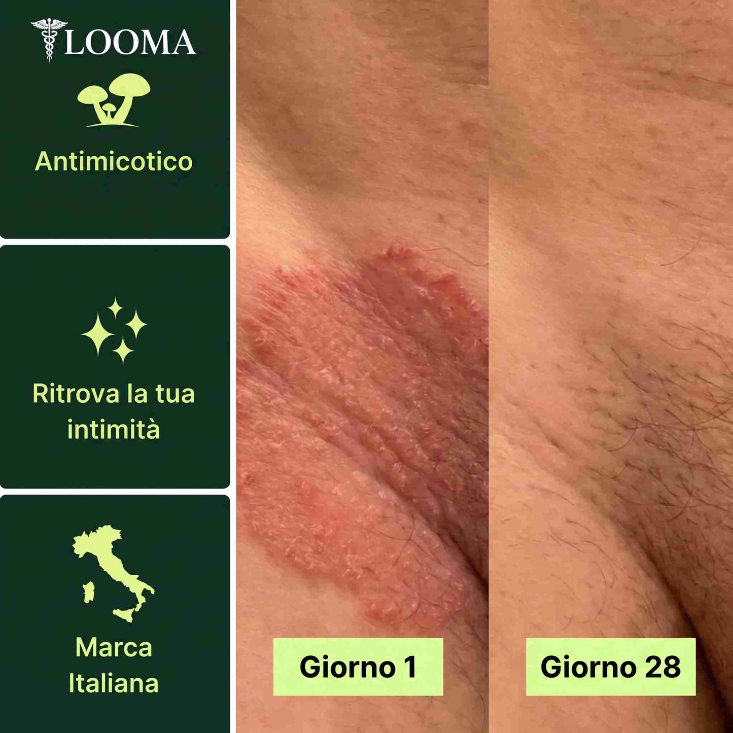 LOOMA™ Sapone Purificante Antifungino