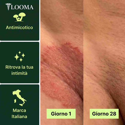 LOOMA™ Sapone Purificante Antifungino
