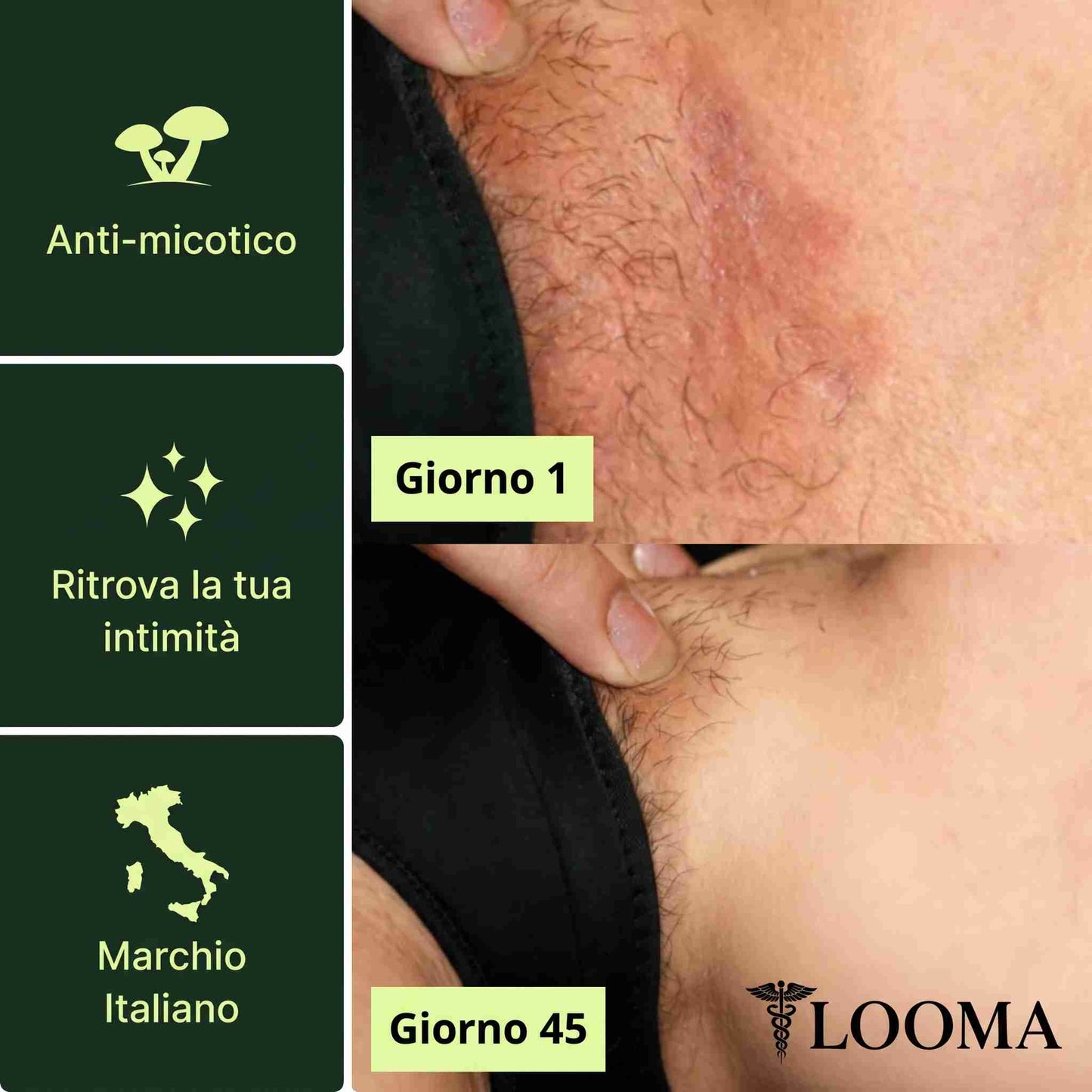 LOOMA™ Sapone Purificante Antifungino